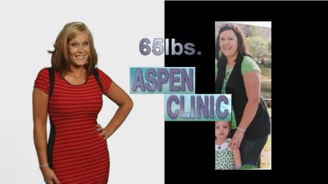 Lost 65 lbs Weight Loss Before and After Picture