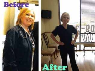 Weight Loss Before and After Picture