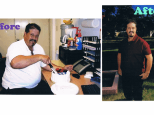 Weight Loss Before and After Picture